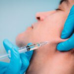 Dermal Fillers